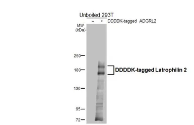 Anti-Latrophilin 2 antibody [HL4090] used in Western Blot (WB). GTX642529
