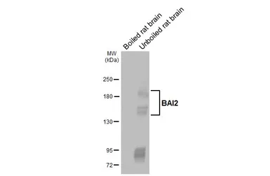 Anti-BAI2 antibody [HL4093] used in Western Blot (WB). GTX642532