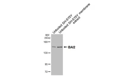 Anti-BAI2 antibody [HL4093] used in Western Blot (WB). GTX642532