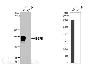 Anti-EGFR antibody [HL1097] used in Western Blot (WB). GTX642543