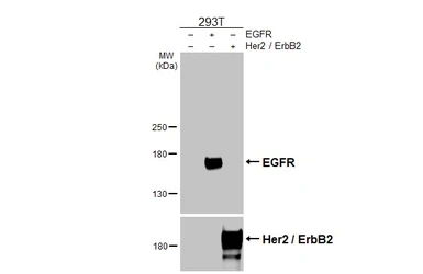 Anti-EGFR antibody [HL1097] used in Western Blot (WB). GTX642543