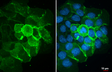 Anti-EGFR antibody [HL1097] used in Immunocytochemistry/ Immunofluorescence (ICC/IF). GTX642543