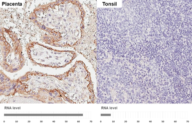 Anti-EGFR antibody [HL1097] used in IHC (Paraffin sections) (IHC-P). GTX642543