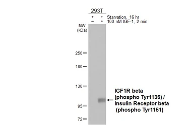 Anti-IGF1R beta (phospho Tyr1316) antibody [HL4099] used in Western Blot (WB). GTX642545