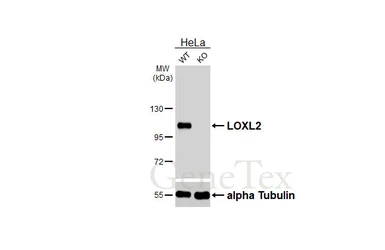 Anti-LOXL2 antibody [HL4109] used in Western Blot (WB). GTX642555