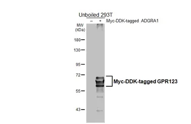 Anti-GPR123 antibody [HL4122] used in Western Blot (WB). GTX642568