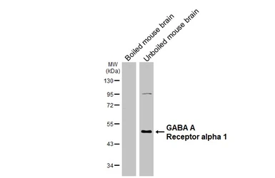 Anti-GABA A Receptor alpha 1 antibody [GT154] used in Western Blot (WB). GTX642581