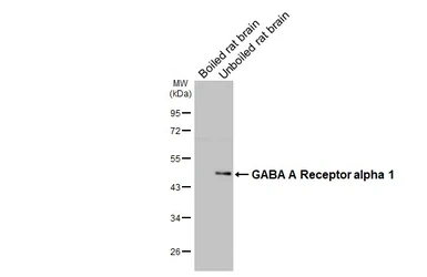 Anti-GABA A Receptor alpha 1 antibody [GT154] used in Western Blot (WB). GTX642581