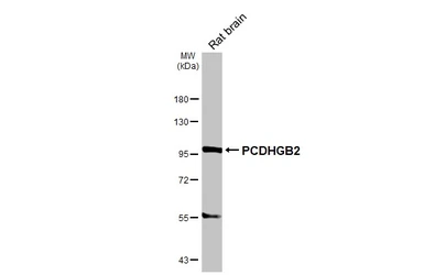 Anti-PCDHGB2 antibody [GT156] used in Western Blot (WB). GTX642583