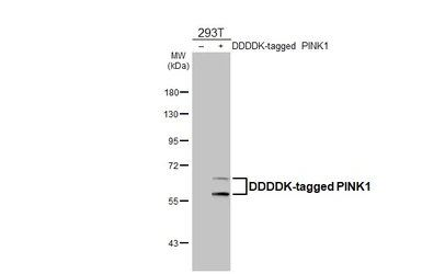 Anti-PINK1 antibody [HL4130] used in Western Blot (WB). GTX642935