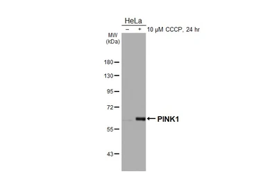 Anti-PINK1 antibody [HL4130] used in Western Blot (WB). GTX642935