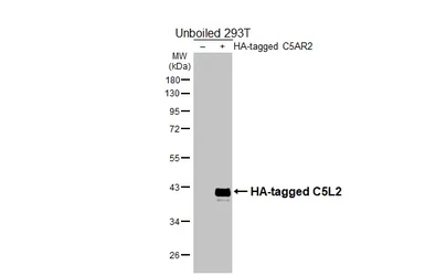 Anti-C5L2 antibody [HL4135] used in Western Blot (WB). GTX642940