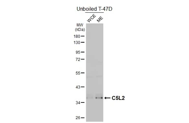 Anti-C5L2 antibody [HL4135] used in Western Blot (WB). GTX642940