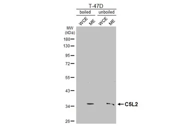 Anti-C5L2 antibody [HL4135] used in Western Blot (WB). GTX642940