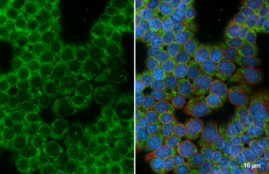 Anti-C5L2 antibody [HL4135] used in Immunocytochemistry/ Immunofluorescence (ICC/IF). GTX642940