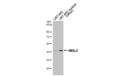 Anti-NEIL2 antibody [HL4144] used in Western Blot (WB). GTX642949