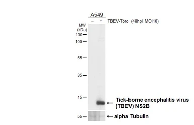 Anti-Tick-borne encephalitis virus NS2B antibody [HL4147] used in Western Blot (WB). GTX642952