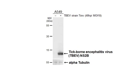 Anti-Tick-borne encephalitis virus (TBEV) NS2B antibody [HL4149] used in Western Blot (WB). GTX642954