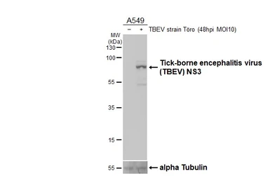 Anti-Tick-borne encephalitis virus (TBEV) NS3 antibody [HL4153] used in Western Blot (WB). GTX642958