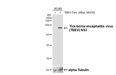Anti-Tick-borne encephalitis virus (TBEV) NS3 antibody [HL4154] used in Western Blot (WB). GTX642959