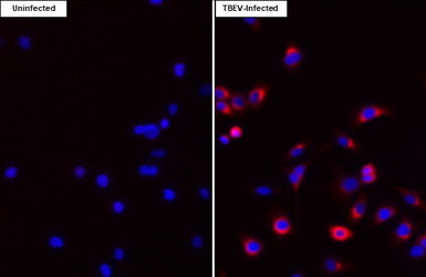 Anti-Tick-borne encephalitis virus (TBEV) NS3 antibody [HL4154] used in Immunocytochemistry/ Immunofluorescence (ICC/IF). GTX642959