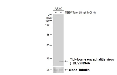 Anti-Tick-borne encephalitis virus NS4A antibody [HL4155] used in Western Blot (WB). GTX642960