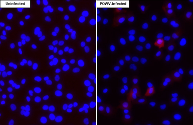 Anti-Powassan virus NS5 antibody [HL4165] used in Immunocytochemistry/ Immunofluorescence (ICC/IF). GTX642970