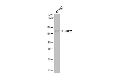 Anti-JIP2 antibody [GT170] used in Western Blot (WB). GTX642976
