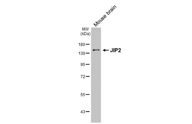 Anti-JIP2 antibody [GT170] used in Western Blot (WB). GTX642976