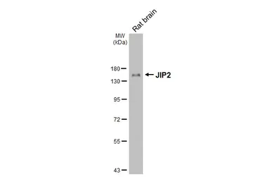 Anti-JIP2 antibody [GT170] used in Western Blot (WB). GTX642976