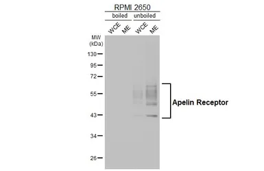 Anti-Apelin Receptor antibody [HL4171] used in Western Blot (WB). GTX642985