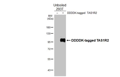 Anti-TAS1R2 antibody [HL4180] used in Western Blot (WB). GTX642994
