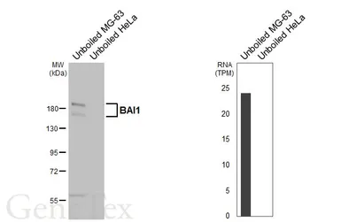 Anti-BAI1 antibody [HL4184] used in Western Blot (WB). GTX642998