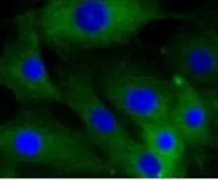 Anti-Caldesmon antibody [GT1108] used in Immunocytochemistry/ Immunofluorescence (ICC/IF). GTX64300