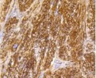 Anti-Caldesmon antibody [GT1108] used in IHC (Paraffin sections) (IHC-P). GTX64300