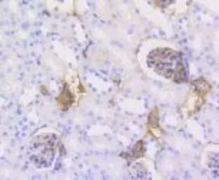 Anti-Caldesmon antibody [GT1108] used in IHC (Paraffin sections) (IHC-P). GTX64300