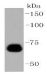 Anti-Caldesmon antibody [GT1108] used in Western Blot (WB). GTX64300