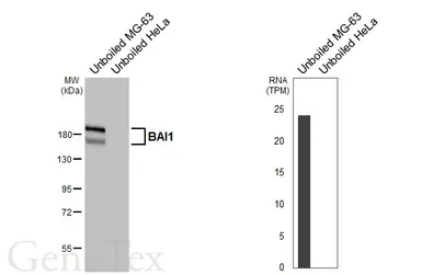 Anti-BAI1 antibody [HL4186] used in Western Blot (WB). GTX643000