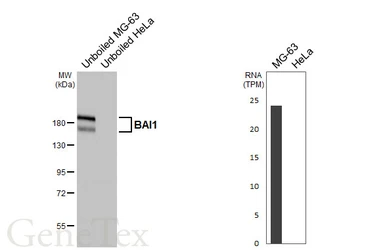 Anti-BAI1 antibody [HL4186] used in Western Blot (WB). GTX643000