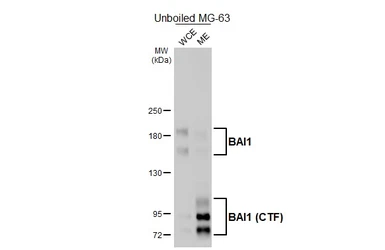 Anti-BAI1 antibody [HL4187] used in Western Blot (WB). GTX643001