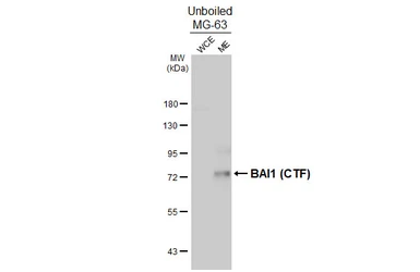 Anti-BAI1 antibody [HL4188] used in Western Blot (WB). GTX643002