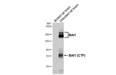 Anti-BAI1 antibody [HL4188] used in Western Blot (WB). GTX643002