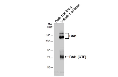 Anti-BAI1 antibody [HL4190] used in Western Blot (WB). GTX643004