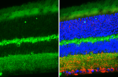 Anti-BAI1 antibody [HL4190] used in IHC (Paraffin sections) (IHC-P). GTX643004