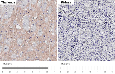 Anti-BAI1 antibody [HL4190] used in IHC (Paraffin sections) (IHC-P). GTX643004