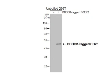 Anti-CD23 antibody [GT176] used in Western Blot (WB). GTX643014
