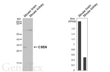 Anti-CSEN antibody [GT177] used in Western Blot (WB). GTX643015