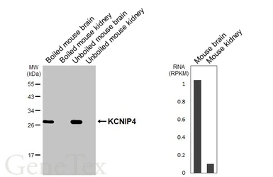 Anti-KCNIP4 antibody [GT178] used in Western Blot (WB). GTX643016