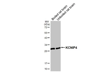 Anti-KCNIP4 antibody [GT178] used in Western Blot (WB). GTX643016