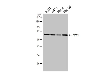 Anti-YY1 antibody [HL4198] used in Western Blot (WB). GTX643021
